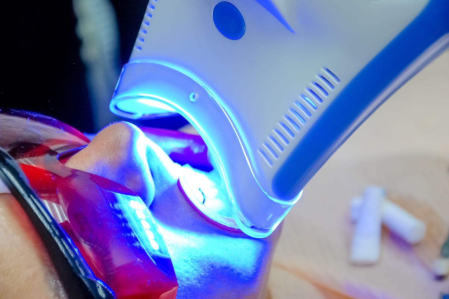 lasers in dentistry has provided many benefits